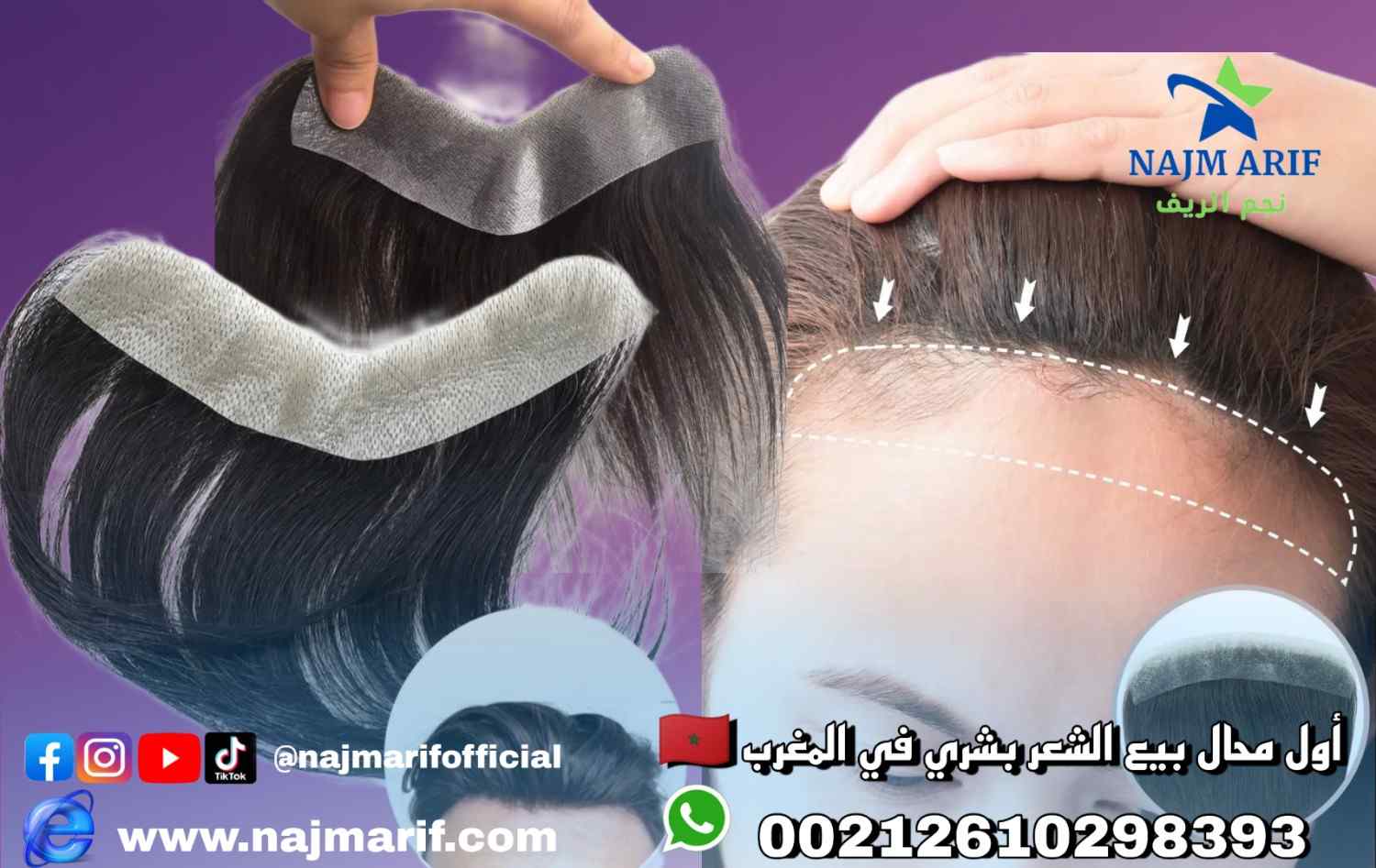 الغُرَة الأمامية