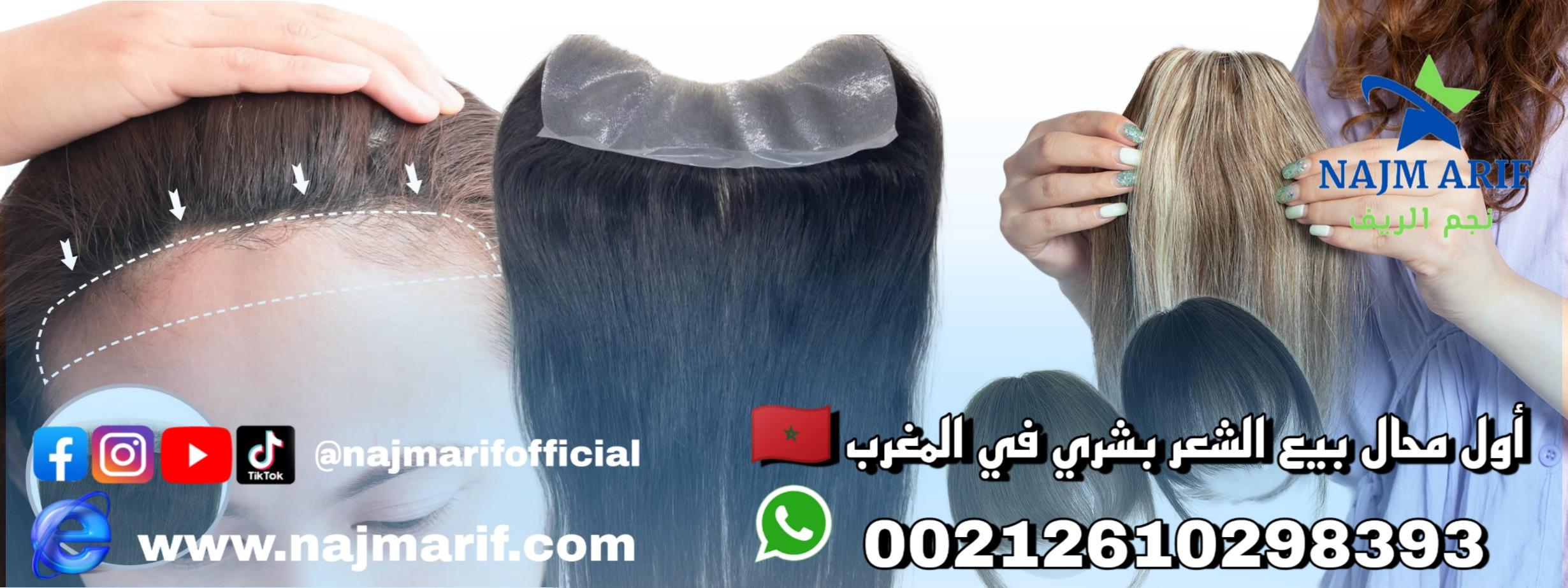 الغُرَة الأمامية